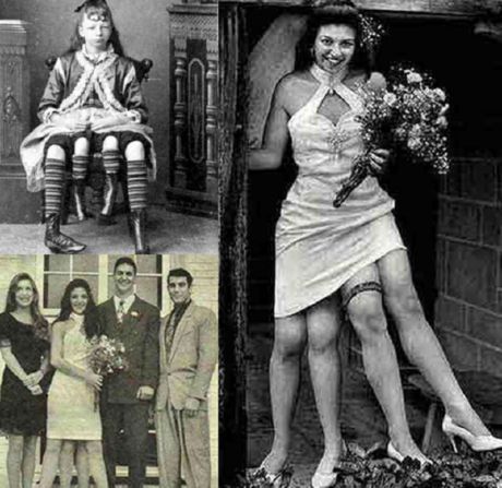 Los mutantes más famosos - La niña de cuatro patas