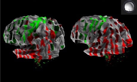 Se ha creado el primer atlas del cerebro humano del mundo