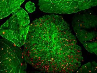Científicos a punto de crear vacunas orales para enfermedades intestinales