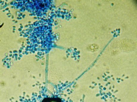 El agente causante del favus (Trichophyton schoenleinii)